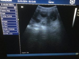Photo of a sonic scan for puppies in a pregnant Labrador bitch with six or more pups showing.